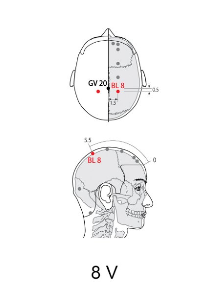 V08