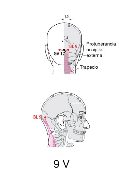 V09