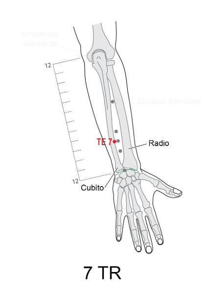 TR07