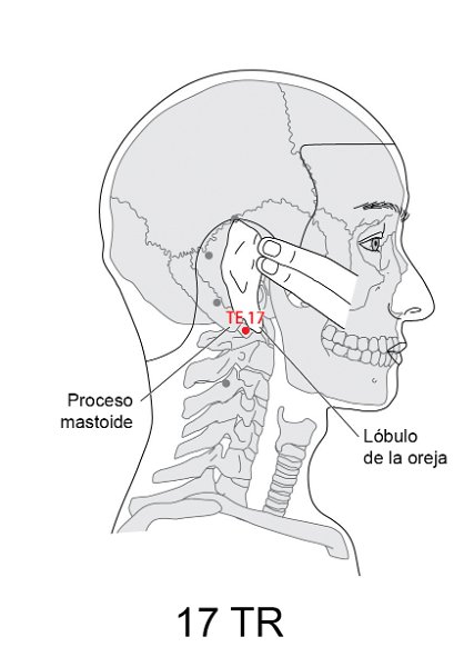 TR17