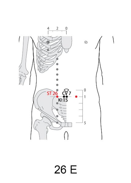 E26